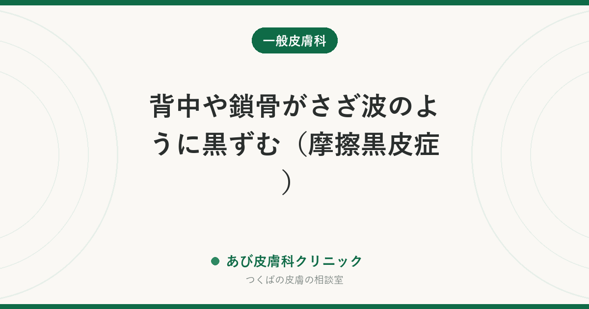 背中や鎖骨がさざ波のように黒ずむ（摩擦黒皮症）｜ナイロンタオルが原因のことも。やめるだけで薄くなる理由