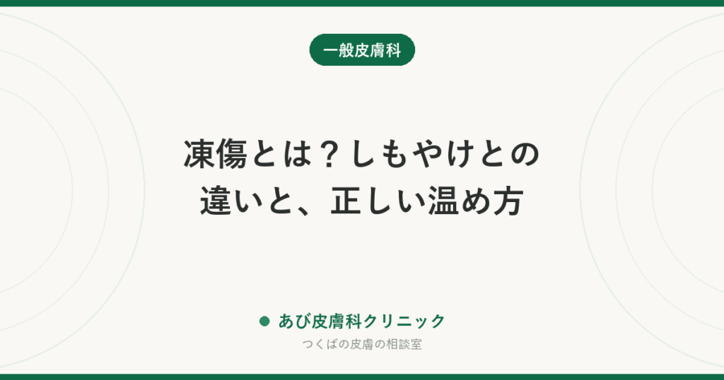 凍傷とは？しもやけとの違いと、正しい温め方｜こすらない・火であぶらない応急処置と、受診が必要なサイン