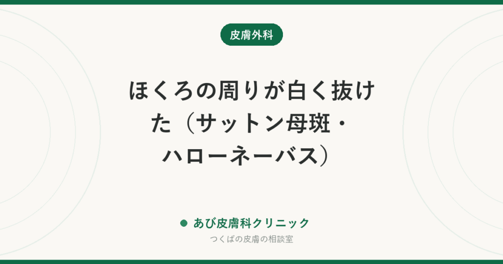 ほくろの周りが白く抜けた（サットン母斑・ハローネーバス）｜白くなる仕組みと経過、一度受診して確かめたいこと