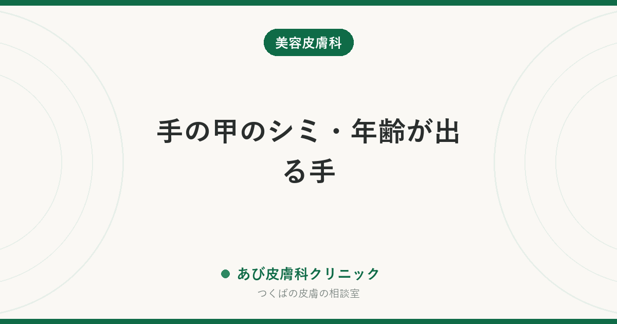 手の甲のシミ・年齢が出る手｜顔より進みやすい理由と、今からできる対策