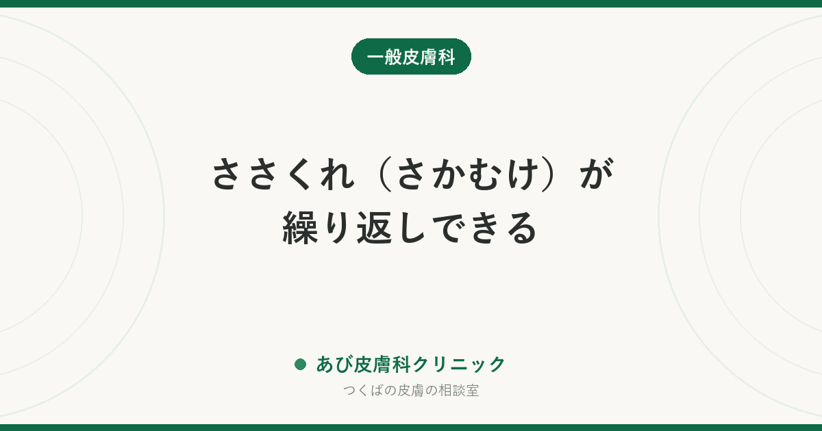 ささくれ（さかむけ）が繰り返しできる｜原因は栄養不足ではなく乾燥。正しい処置と化膿を防ぐコツ