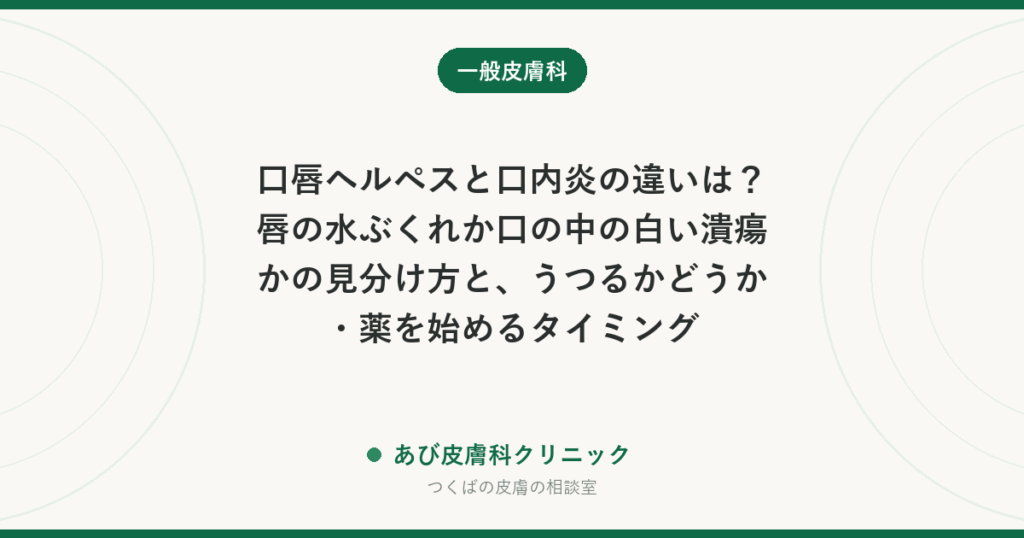 口唇ヘルペスと口内炎の違いは？唇の水ぶくれか口の中の白い潰瘍かの見分け方と、うつるかどうか・薬を始めるタイミング