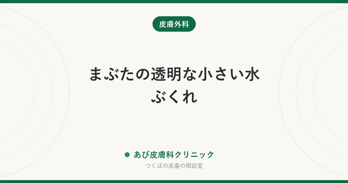 まぶたの透明な小さい水ぶくれ｜汗嚢腫（かんのうしゅ）とは？稗粒腫・ものもらいとの違いと治療法