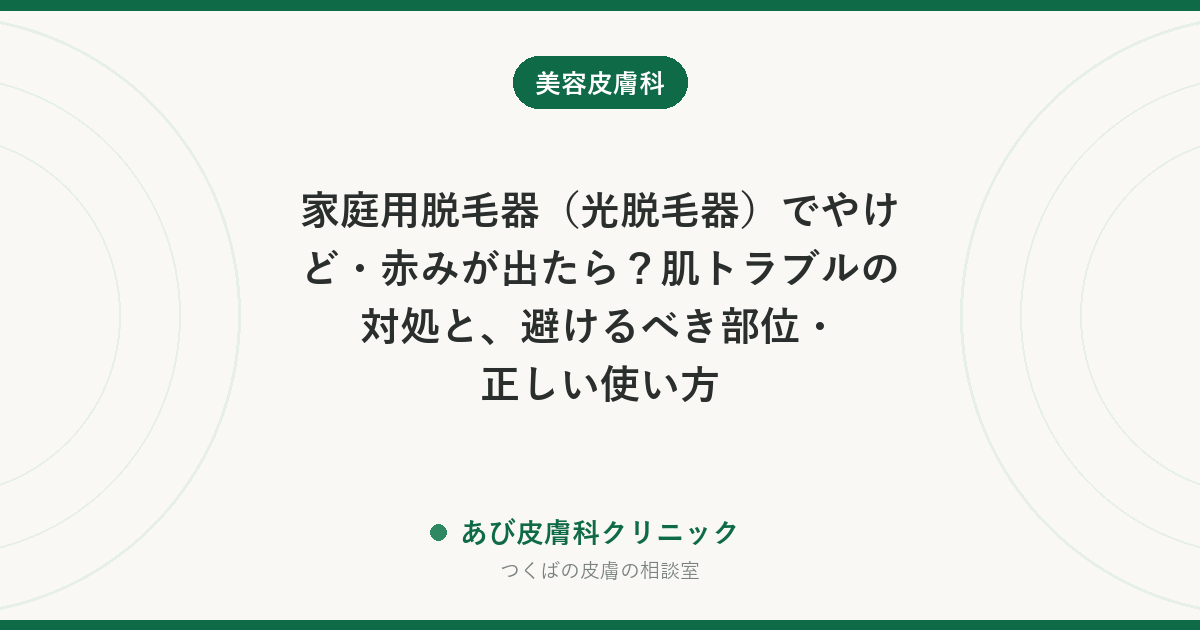 家庭用脱毛器（光脱毛器）でやけど・赤みが出たら？肌トラブルの対処と、避けるべき部位・正しい使い方