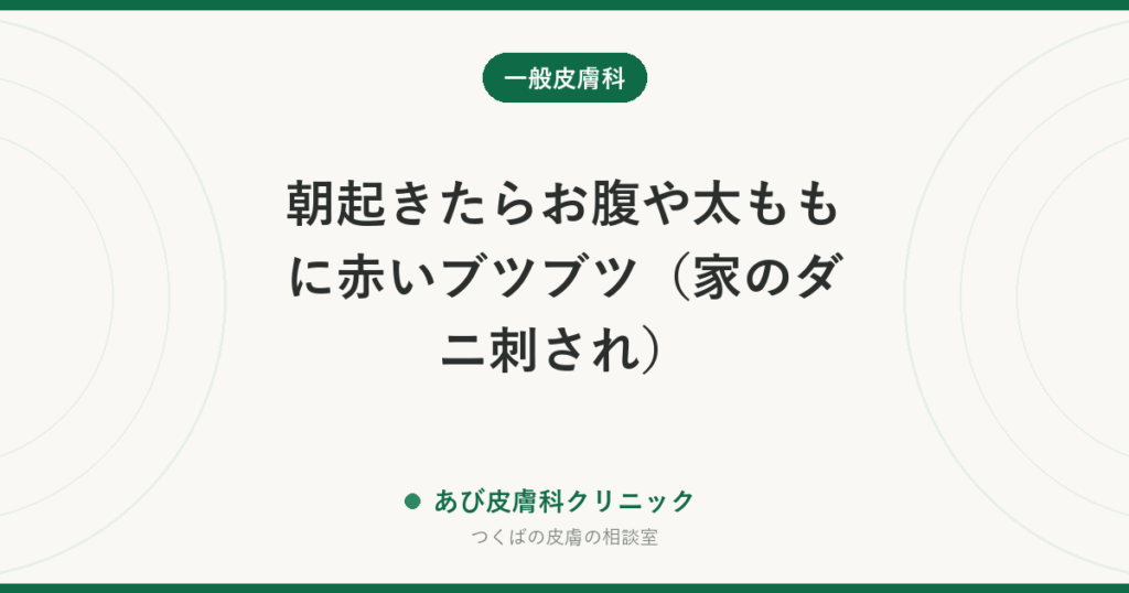 朝起きたらお腹や太ももに赤いブツブツ（家のダニ刺され）｜ツメダニ・イエダニの見分けと、布団・部屋の対策