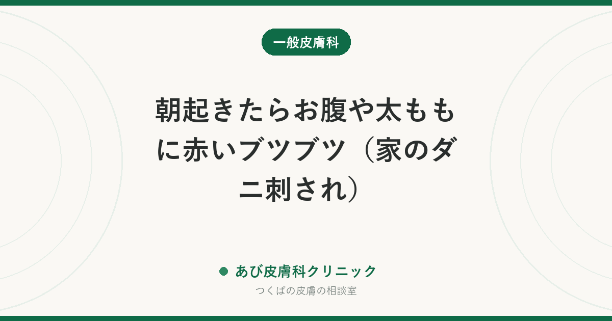 朝起きたらお腹や太ももに赤いブツブツ（家のダニ刺され）｜ツメダニ・イエダニの見分けと、布団・部屋の対策
