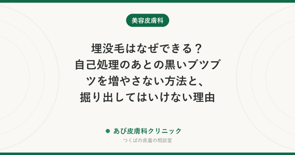 埋没毛はなぜできる？自己処理のあとの黒いブツブツを増やさない方法と、掘り出してはいけない理由