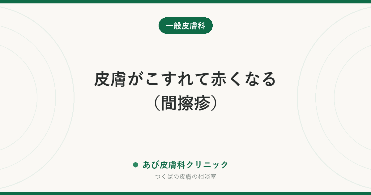 皮膚がこすれて赤くなる(間擦疹)|股・わき・お腹のしわの赤みと、カンジダ・水虫の見分け