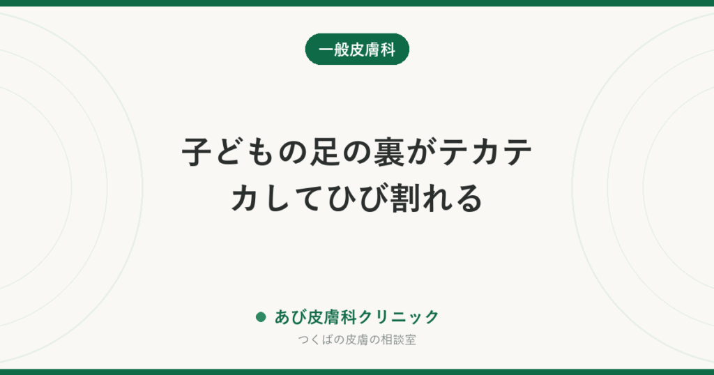 子どもの足の裏がテカテカしてひび割れる｜若年性足底皮膚炎とは？水虫との見分け方と靴下・靴の工夫