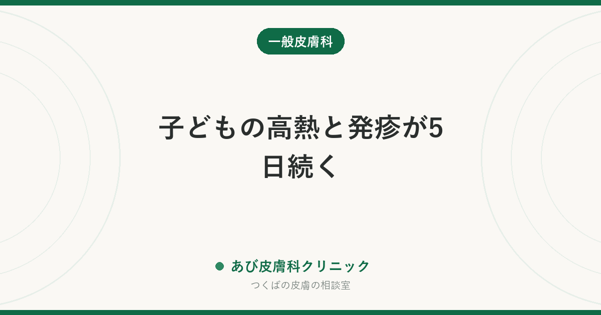子どもの高熱と発疹が5日続く｜川崎病で見るべき6つの症状と、ただの発疹と分ける考え方