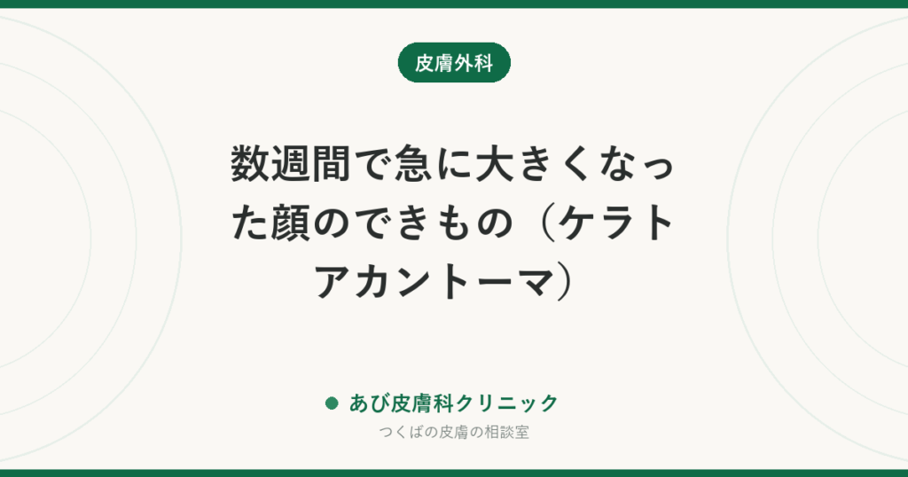 数週間で急に大きくなった顔のできもの（ケラトアカントーマ）｜中央がくぼむドーム状。取って調べるのが基本