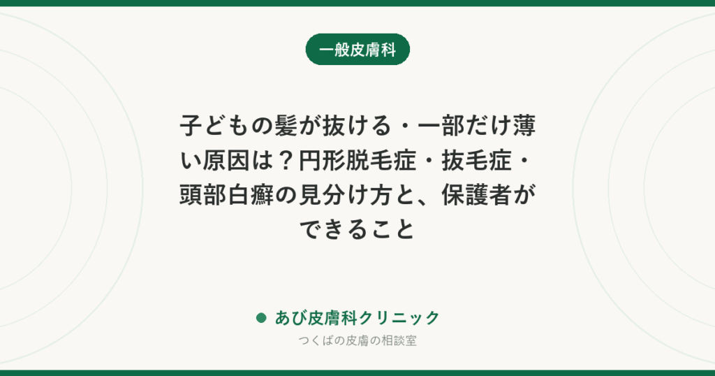 子どもの髪が抜ける・一部だけ薄い原因は？円形脱毛症・抜毛症・頭部白癬の見分け方と、保護者ができること
