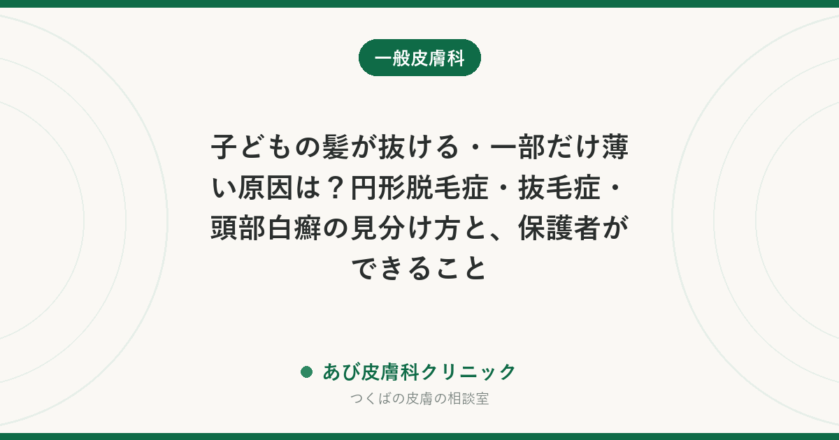 子どもの髪が抜ける・一部だけ薄い原因は？円形脱毛症・抜毛症・頭部白癬の見分け方と、保護者ができること