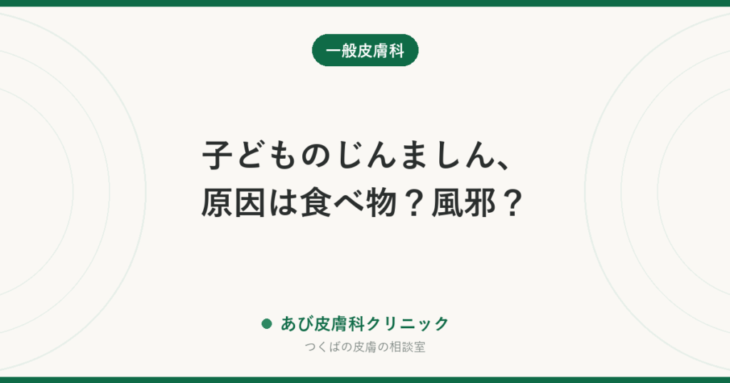 子どものじんましん、原因は食べ物？風邪？｜急に出たときの家での対処と、救急に行くべきサイン・受診の目安