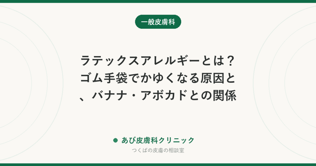ラテックスアレルギーとは？ゴム手袋でかゆくなる原因と、バナナ・アボカドとの関係