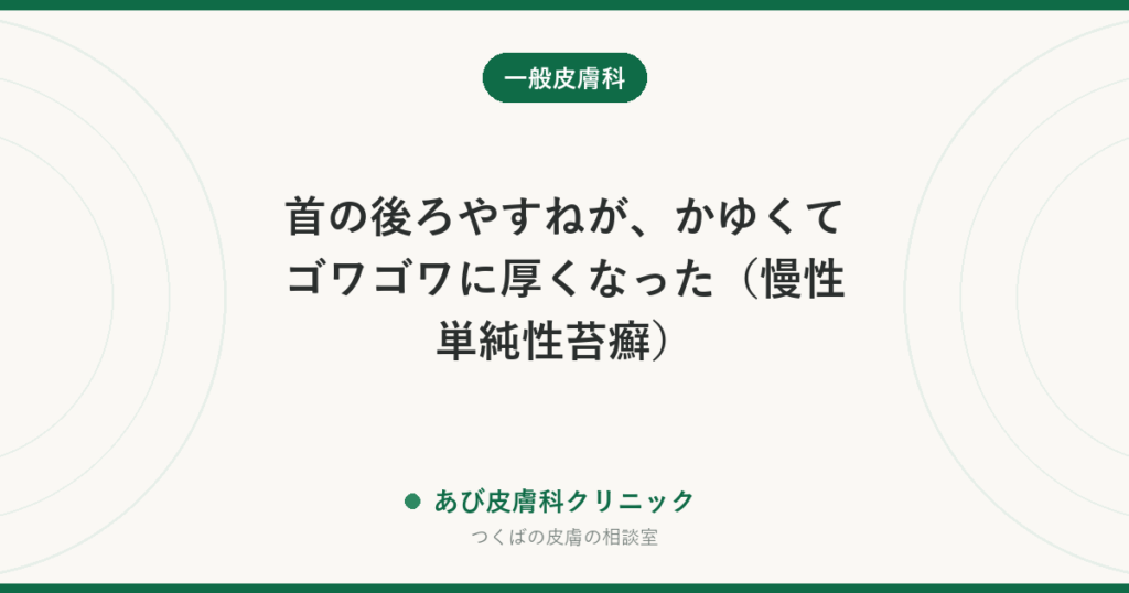 首の後ろやすねが、かゆくてゴワゴワに厚くなった（慢性単純性苔癬）｜かく→厚くなる→かゆいの悪循環を断つ治し方