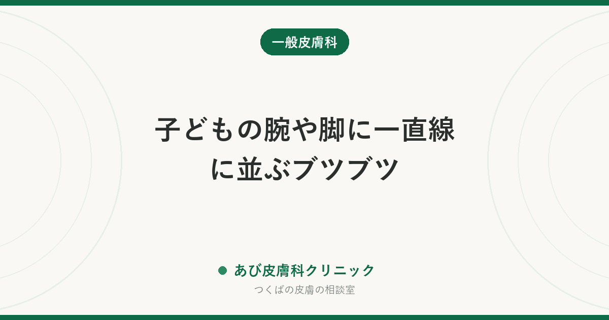 子どもの腕や脚に一直線に並ぶブツブツ|線状苔癬(せんじょうたいせん)とは?うつる?治るまでの期間