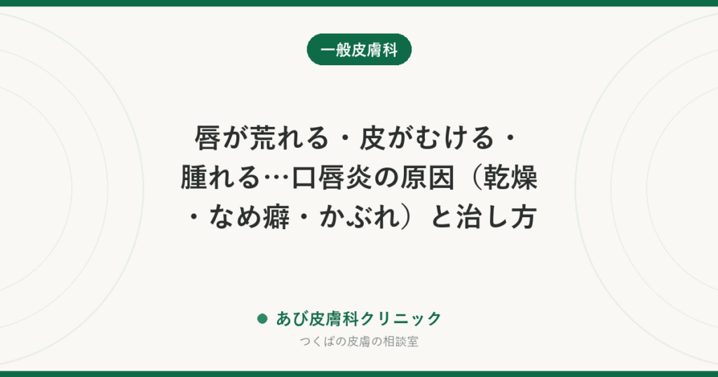 唇が荒れる・皮がむける・腫れる…口唇炎の原因（乾燥・なめ癖・かぶれ）と治し方