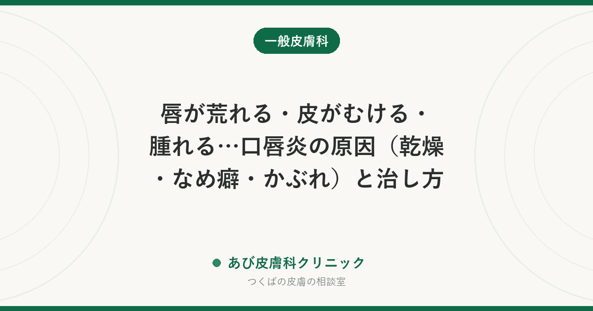 唇が荒れる・皮がむける・腫れる…口唇炎の原因（乾燥・なめ癖・かぶれ）と治し方