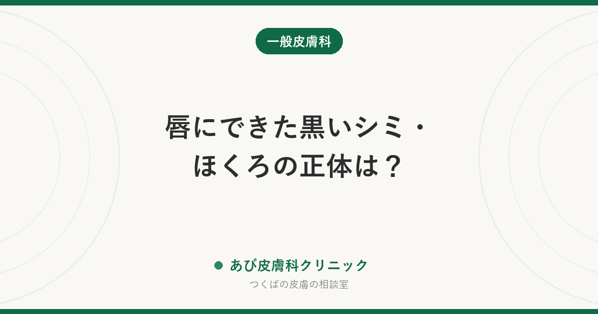 唇にできた黒いシミ・ほくろの正体は？｜色素斑・ほくろ・静脈湖の見分け方と、早めに診てもらいたいサイン