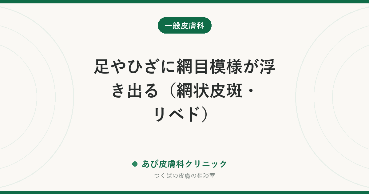 足やひざに網目模様が浮き出る（網状皮斑・リベド）｜温めると消えるなら心配は少ない。受診が必要なサイン