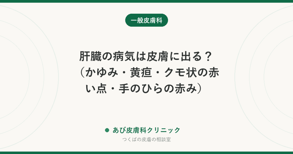 肝臓の病気は皮膚に出る？（かゆみ・黄疸・クモ状の赤い点・手のひらの赤み）｜皮膚から気づくサインと受診先