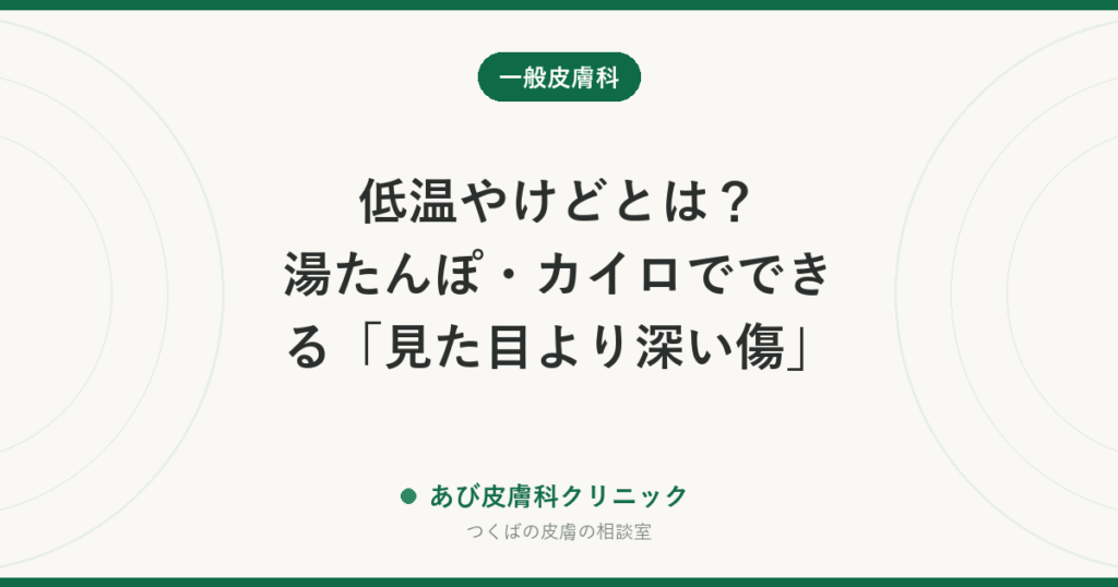 低温やけどとは？湯たんぽ・カイロでできる「見た目より深い傷」｜水ぶくれの扱いと受診の目安