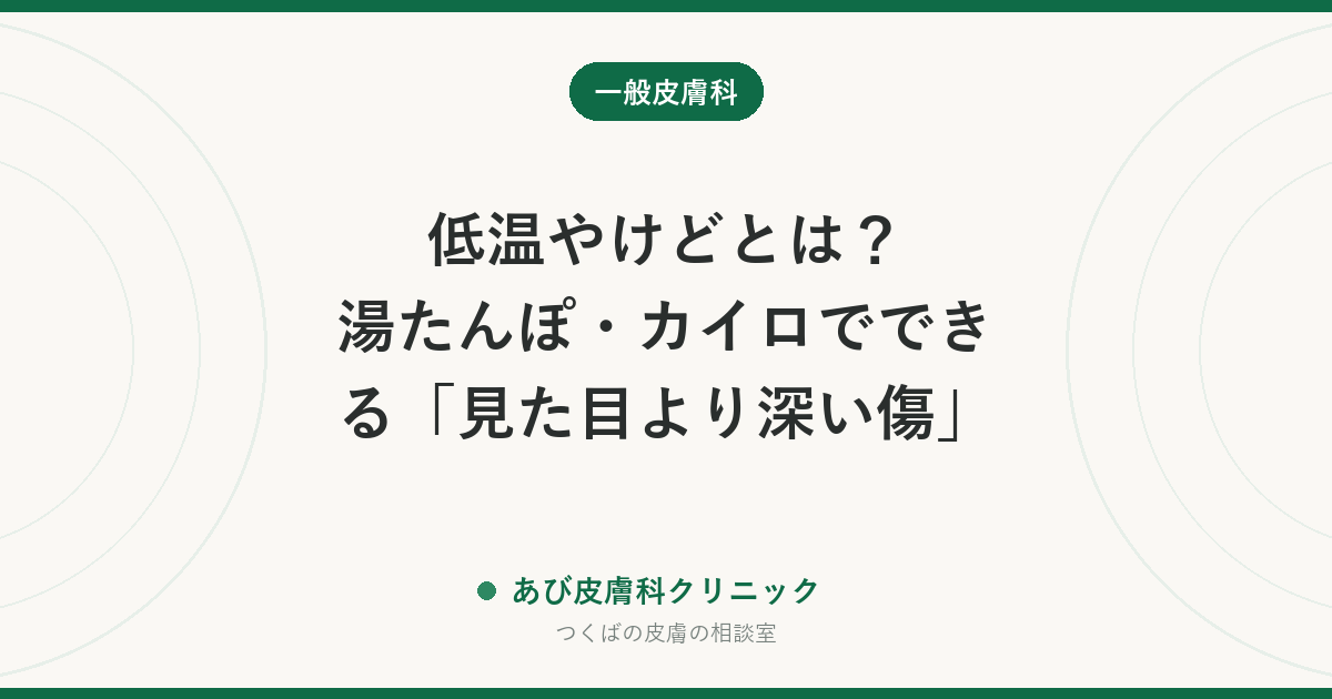 低温やけどとは？湯たんぽ・カイロでできる「見た目より深い傷」｜水ぶくれの扱いと受診の目安