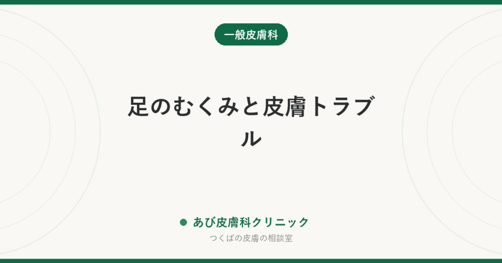 足のむくみと皮膚トラブル｜乾燥・かゆみを放置すると蜂窩織炎を繰り返します