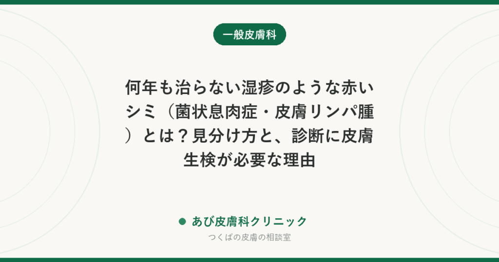 何年も治らない湿疹のような赤いシミ（菌状息肉症・皮膚リンパ腫）とは？見分け方と、診断に皮膚生検が必要な理由