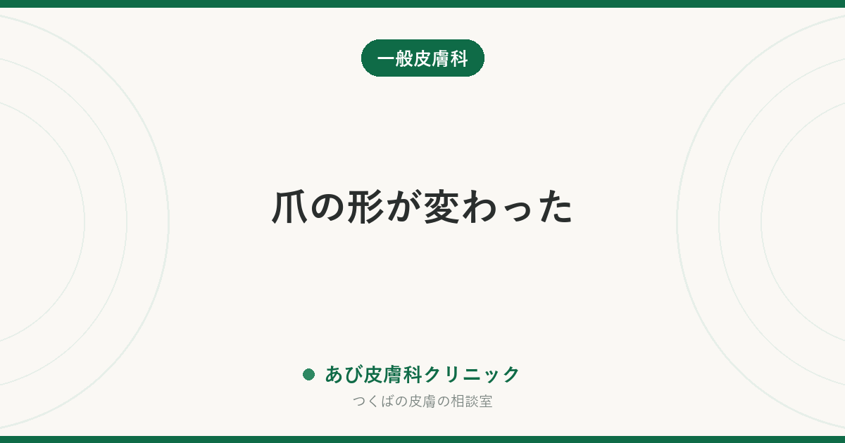爪の形が変わった｜スプーン爪・ばち指・でこぼこが知らせる体のサインと、受診の目安