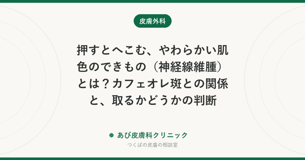 押すとへこむ、やわらかい肌色のできもの（神経線維腫）とは？カフェオレ斑との関係と、取るかどうかの判断