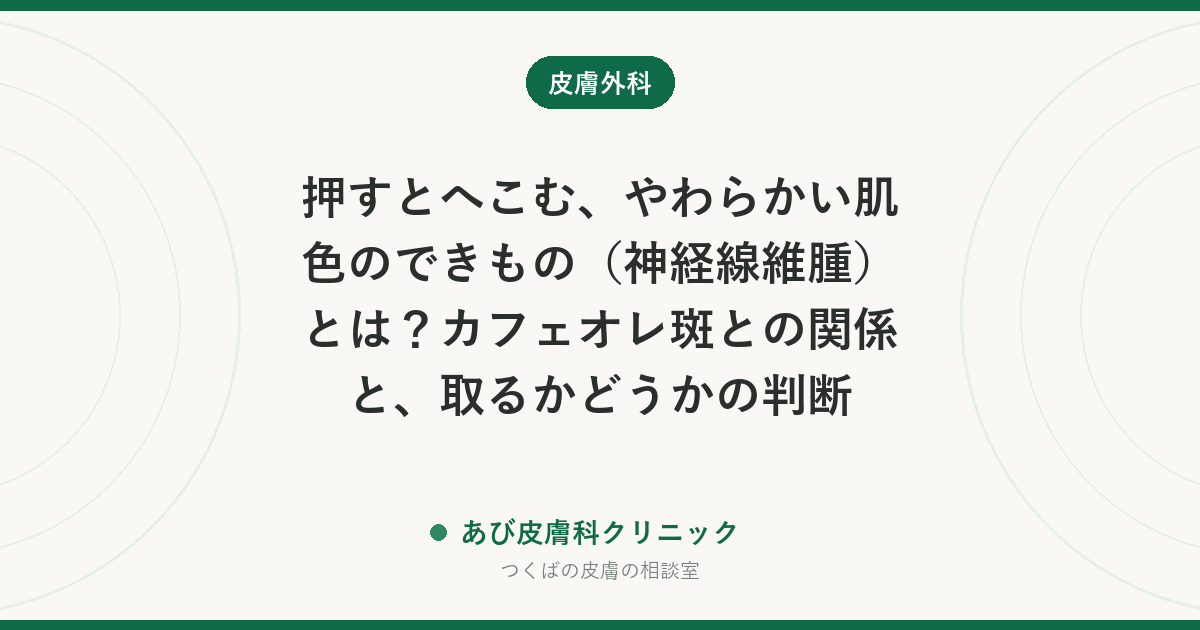 押すとへこむ、やわらかい肌色のできもの（神経線維腫）とは？カフェオレ斑との関係と、取るかどうかの判断