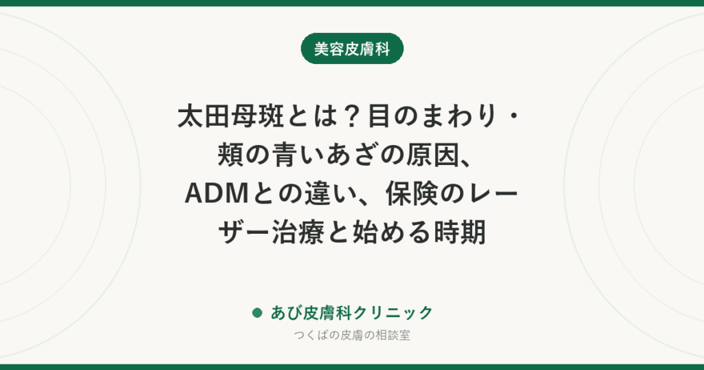 太田母斑とは？目のまわり・頬の青いあざの原因、ADMとの違い、保険のレーザー治療と始める時期
