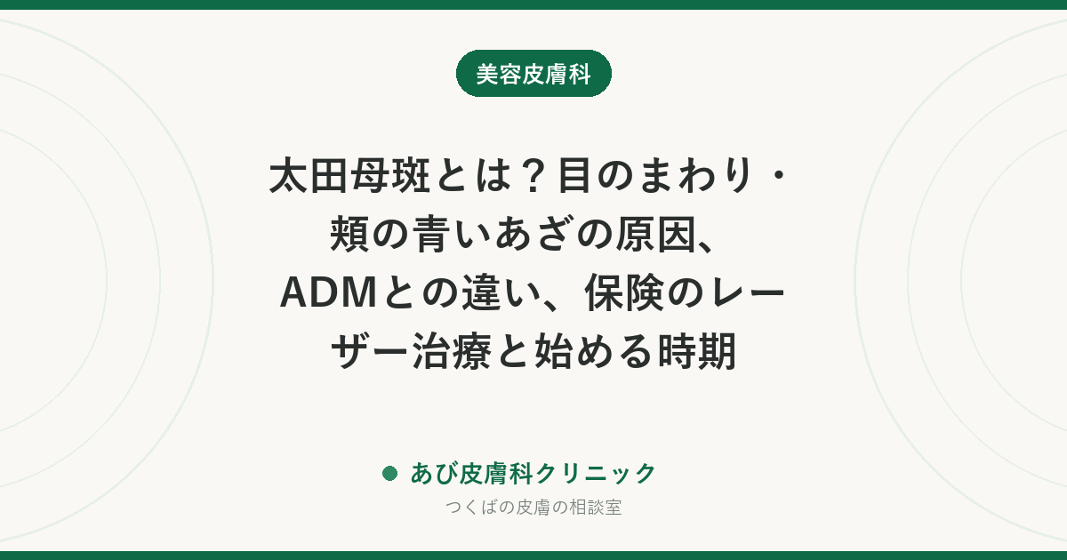 太田母斑とは?目のまわり・頬の青いあざの原因、ADMとの違い、保険のレーザー治療と始める時期