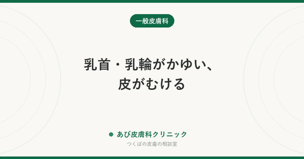 乳首・乳輪がかゆい、皮がむける｜乳頭湿疹の原因とケア、片側だけのときに確かめること
