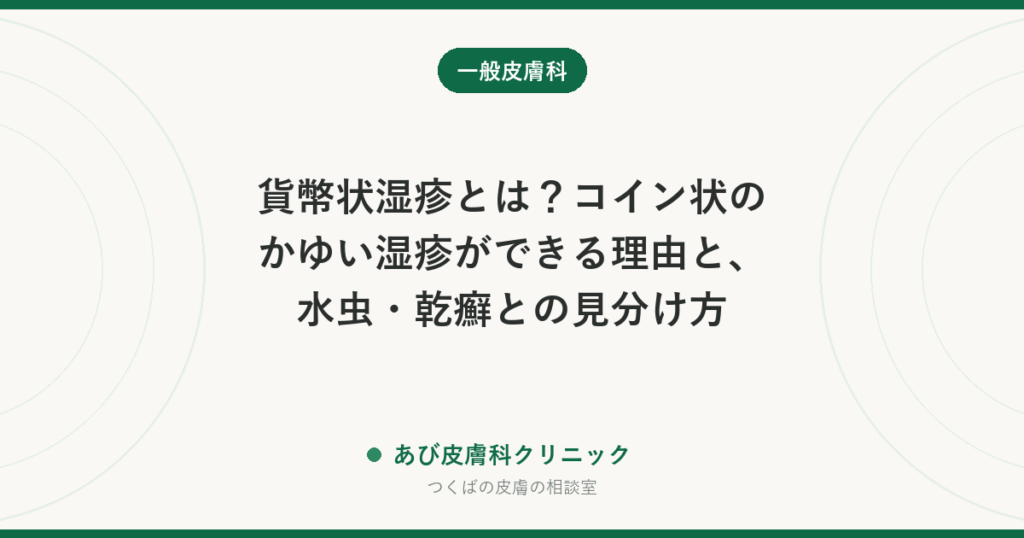 貨幣状湿疹とは？コイン状のかゆい湿疹ができる理由と、水虫・乾癬との見分け方