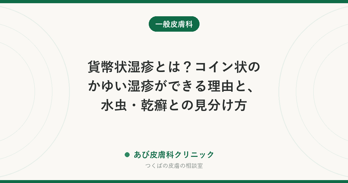 貨幣状湿疹とは？コイン状のかゆい湿疹ができる理由と、水虫・乾癬との見分け方