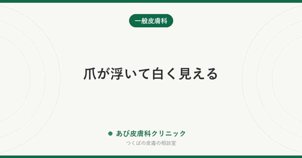 爪が浮いて白く見える｜爪甲剥離症の原因と、爪水虫との見分け方
