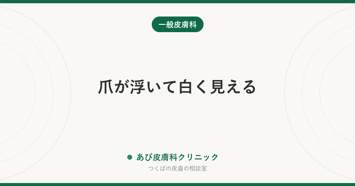 爪が浮いて白く見える｜爪甲剥離症の原因と、爪水虫との見分け方