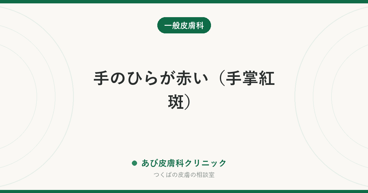 手のひらが赤い（手掌紅斑）｜かゆみがなければ体質のことも多い。急に赤くなったら肝臓などを確認