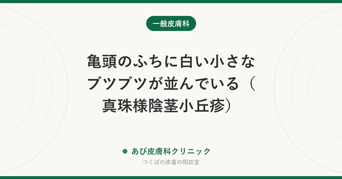 亀頭のふちに白い小さなブツブツが並んでいる（真珠様陰茎小丘疹）｜性病ではない理由と、尖圭コンジローマとの見分け方