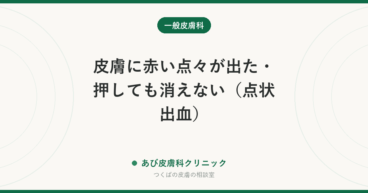 皮膚に赤い点々が出た・押しても消えない（点状出血）｜多くは一時的。発熱や出血を伴えばすぐ受診