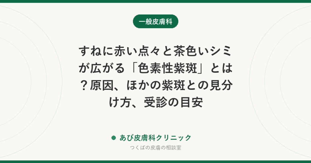 すねに赤い点々と茶色いシミが広がる「色素性紫斑」とは？原因、ほかの紫斑との見分け方、受診の目安
