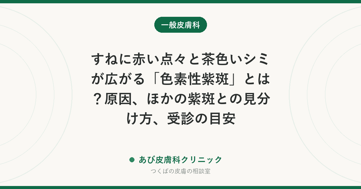 すねに赤い点々と茶色いシミが広がる「色素性紫斑」とは？原因、ほかの紫斑との見分け方、受診の目安