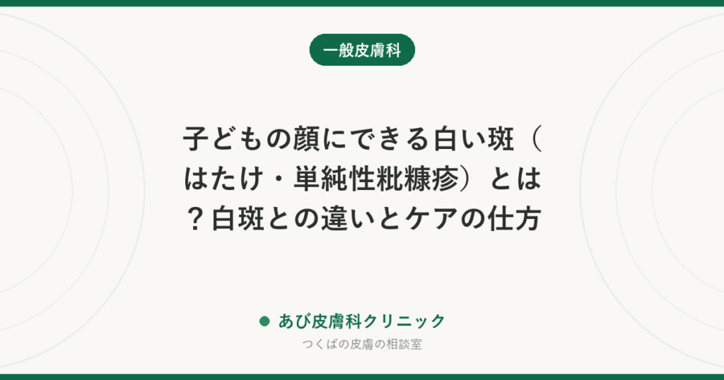 子どもの顔にできる白い斑（はたけ・単純性粃糠疹）とは？白斑との違いとケアの仕方