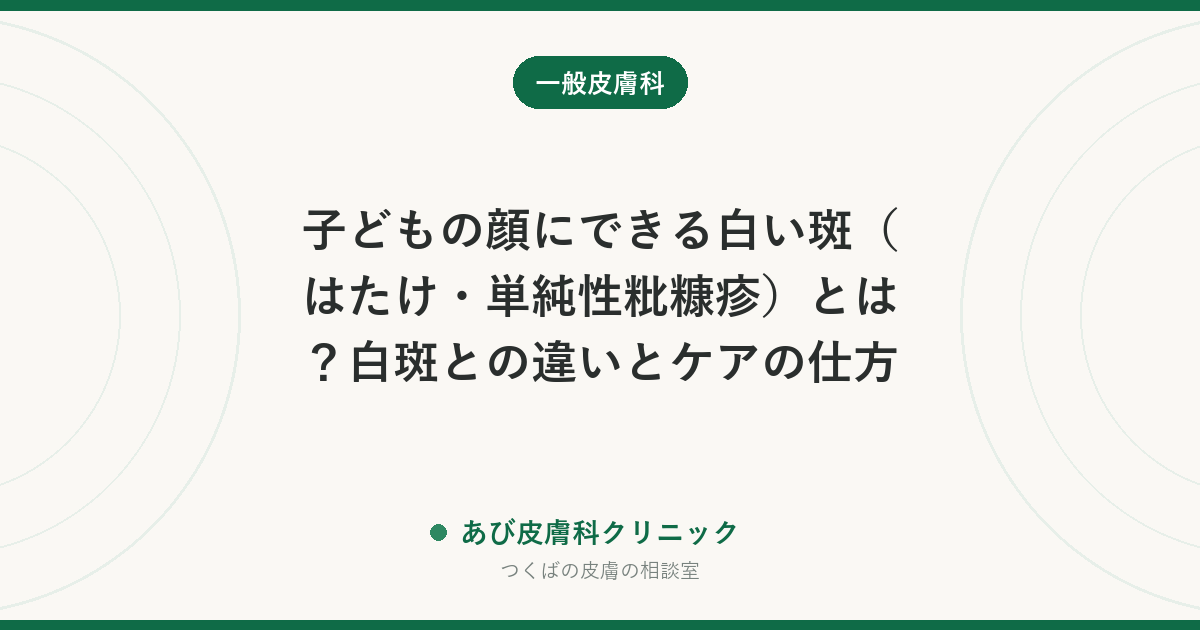 子どもの顔にできる白い斑（はたけ・単純性粃糠疹）とは？白斑との違いとケアの仕方