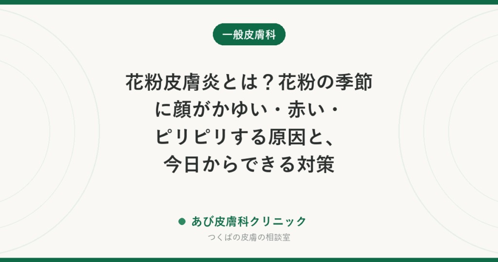 花粉皮膚炎とは？花粉の季節に顔がかゆい・赤い・ピリピリする原因と、今日からできる対策