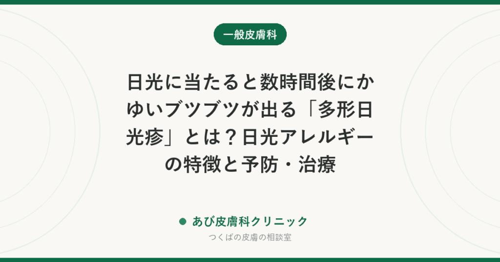 日光に当たると数時間後にかゆいブツブツが出る「多形日光疹」とは？日光アレルギーの特徴と予防・治療