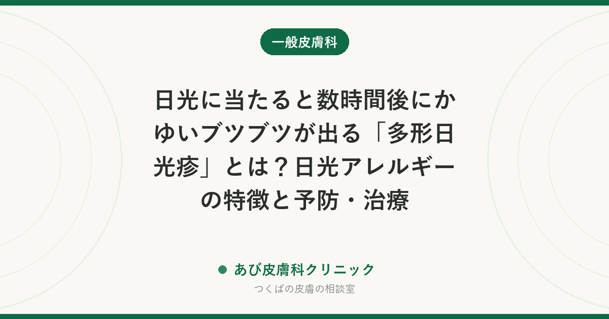 日光に当たると数時間後にかゆいブツブツが出る「多形日光疹」とは?日光アレルギーの特徴と予防・治療